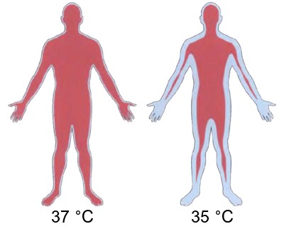 Immagine di un corpo a 37 ed a 35 gradi in ipotermia